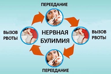 Лечение булимии в Красноусольском
